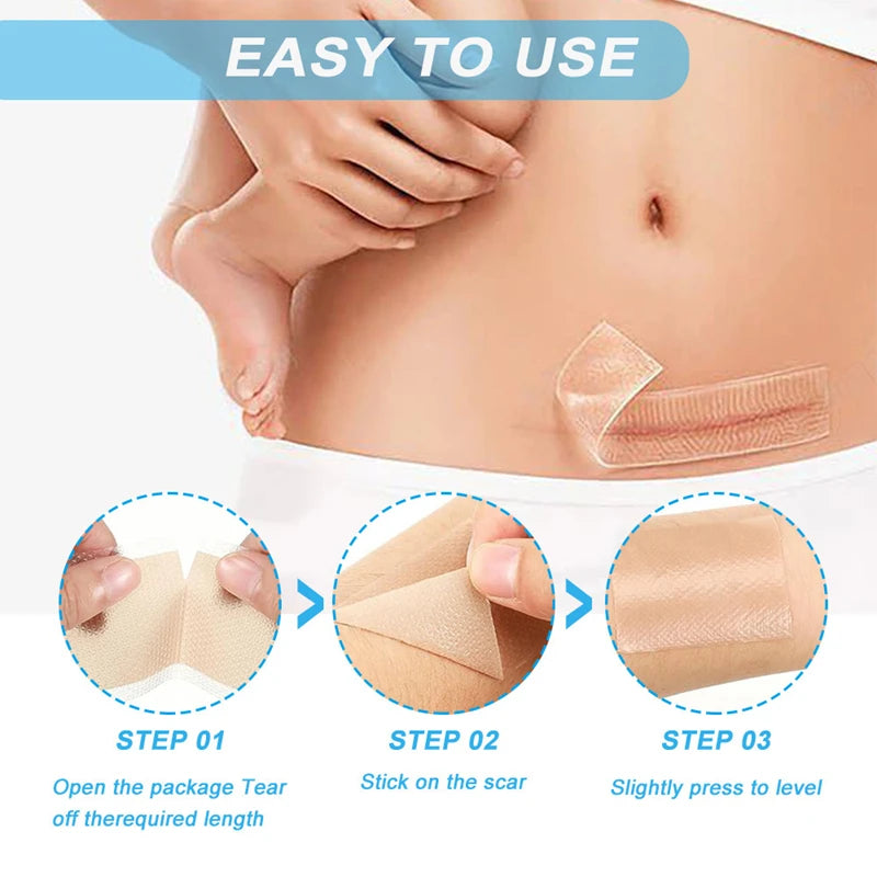 Silicone Gel Scar Patch
